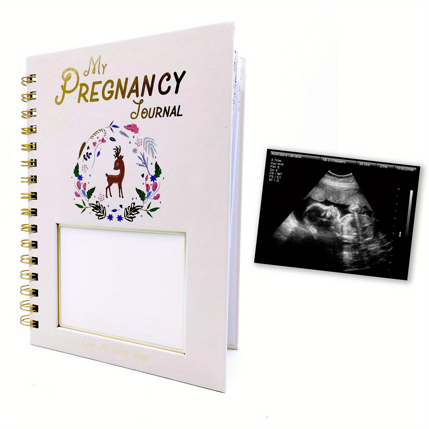 Spiral Bound Pregnancy Journal with Floral Design Golden Foil Cover Ultrasound Photo Slot Memory Diary Gift For New Moms